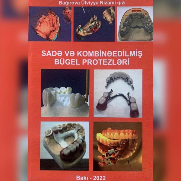 Sadə və kombinəedilmiş bügel protezləri